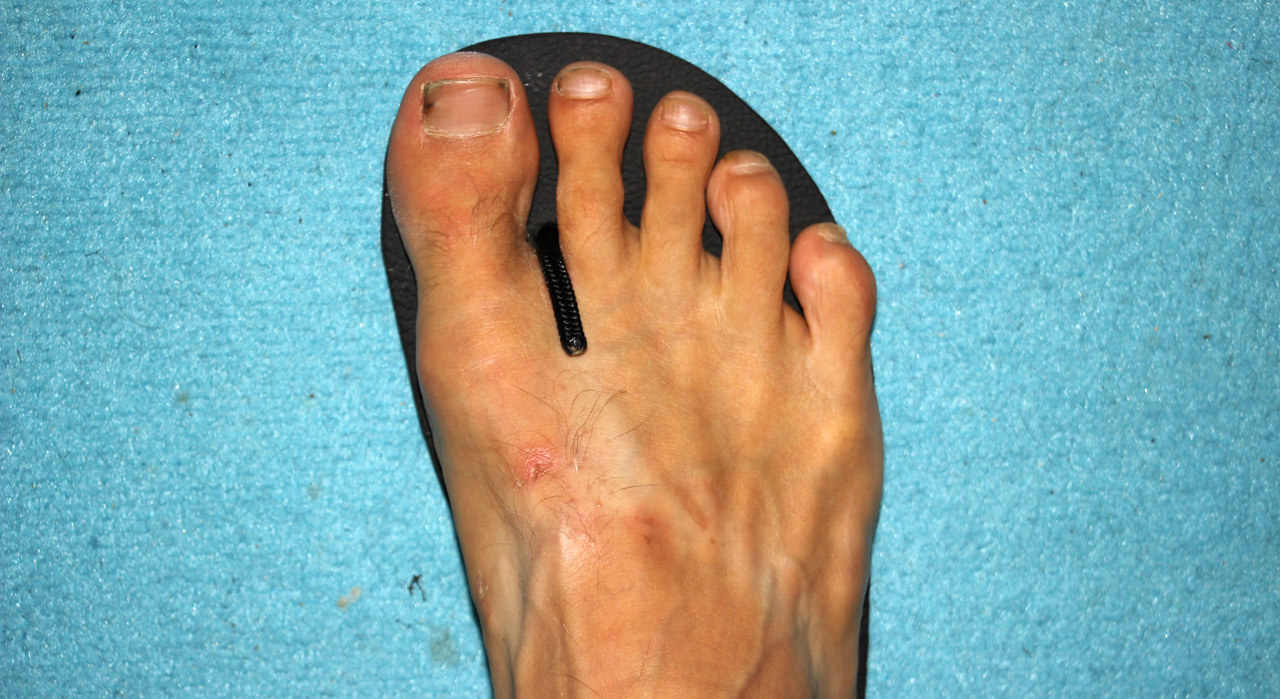 Výroba barefoot sandálov - primeranie dĺžky popruhu